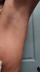solo-armpits